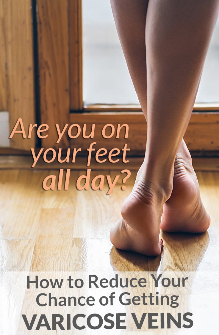 Are you on your feet all day? How to reduce your chance of getting varicose veins.