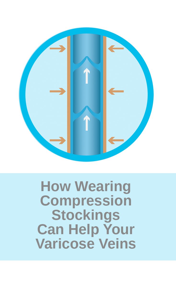 blog-compressionstockings-pin