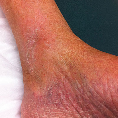 blog-vu-after2