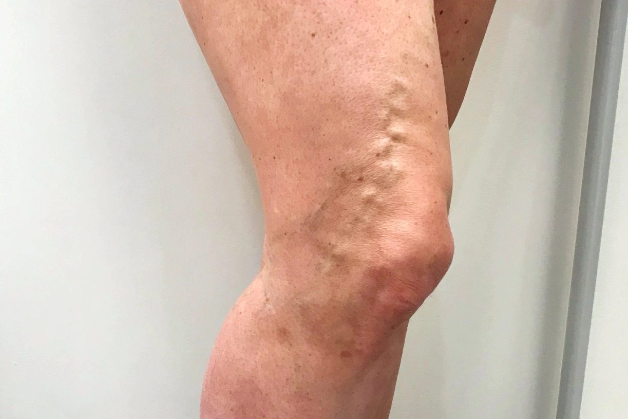 Patient Case Study - Before