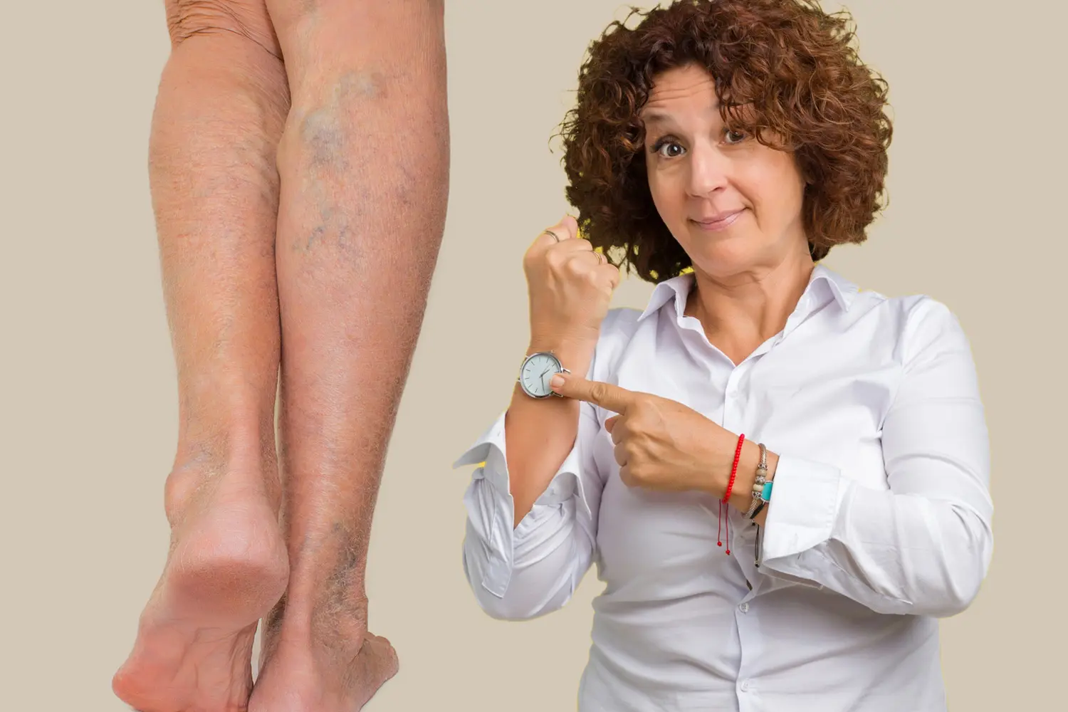 A woman pointing to her watch and showing a leg with varicose veins.