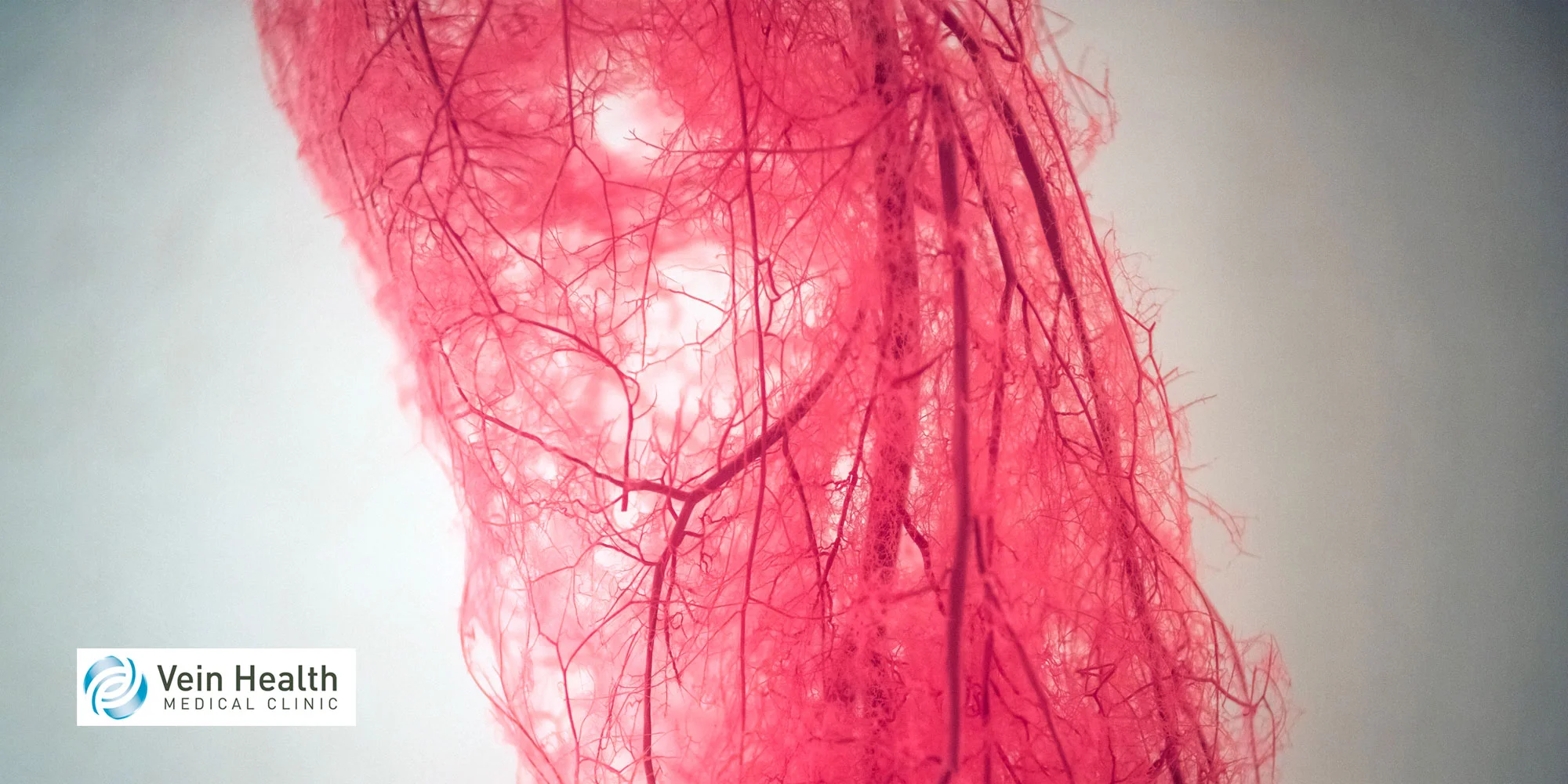 A close up of a blood vessels in the leg
